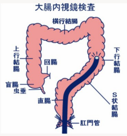 连续胃疼的原因是什么